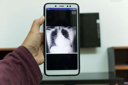 Negeri Sembilan, Malaysia - August 30, 2018: Dailyrounds application on smartphone. It is an application to help medical students in daily hospital rounds.のeditorial素材