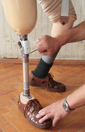 Hands machinery governing prosthetic leg on man