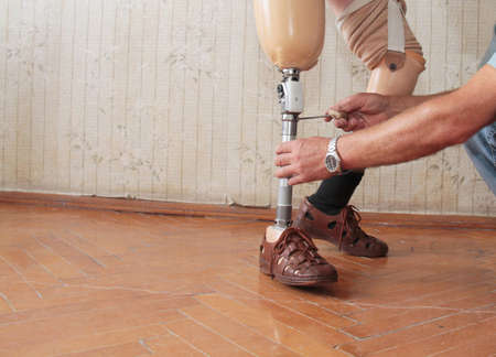 Hands machinery governing prosthetic leg on manの写真素材