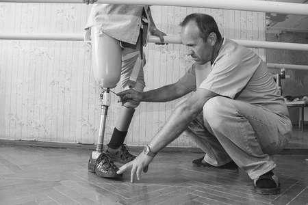 KOVEL, UKRAINE - 2 September 2014: Machinery governing prosthetic leg on manのeditorial素材