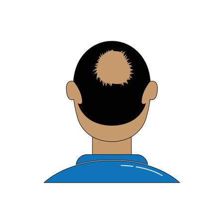 Hair loss color icon. Balding. Declining testosterone. Alopecia, baldness. Men aging. Isolated vector illustrationのイラスト素材
