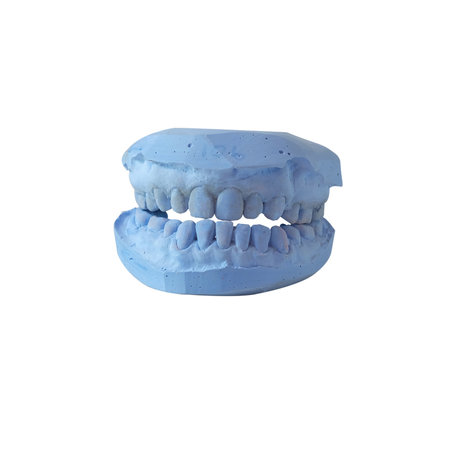 Blue Dental mold on white background.oral care and medical concept.