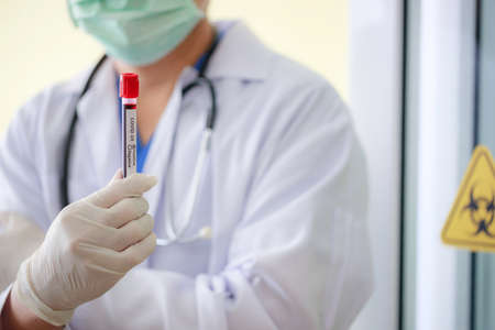 Close up exam blood tube in doctorâs hand. Technician holding blood tube test in the research laboratory.の写真素材