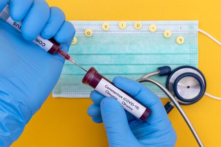 Laboratory testing patientâs blood samples for presence of coronavirus (COVID-19), Hand holds a test tube containing a blood sample that has no the result positive or negative for coronavirus.の写真素材