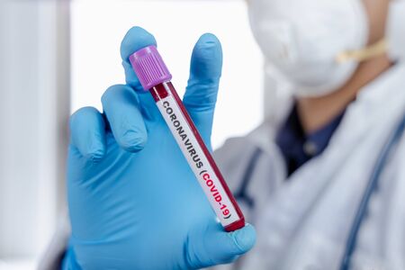 Laboratory testing patientâs blood samples for presence of coronavirus (COVID-19) The doctor holds a test tube containing a blood sample that has no the result positive or negative for coronavirus.の写真素材