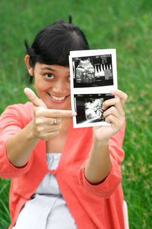 pregnant asian woman pointing to ultrasound scanの写真素材