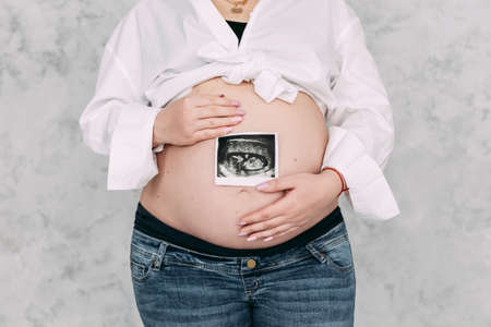 Close up of pregnant woman holding ultrasound scan on her tummyの写真素材