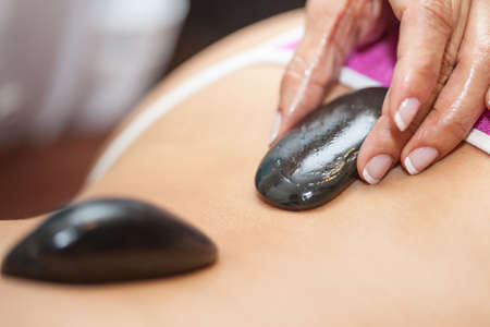 Doctor performing a hot volcanic stones therapy on a young female patient backの写真素材