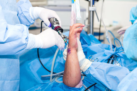 Group of orthopedic surgeons performing a wrist arthroscopy on a male patient