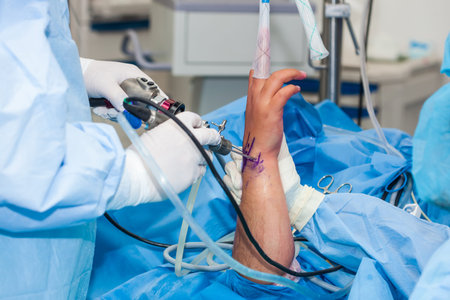Group of orthopedic surgeons performing a wrist arthroscopy on a male patient