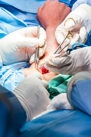 Group of orthopedic surgeons performing surgery on a patient arm