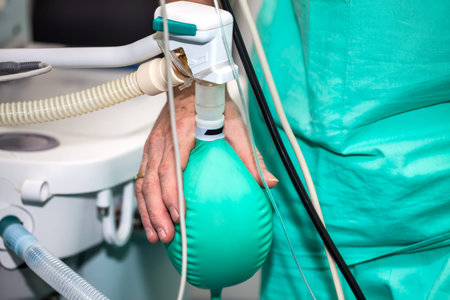 Close up of a doctor hand pressing the anesthesia rebreathing bag while surgical team prepares their...
