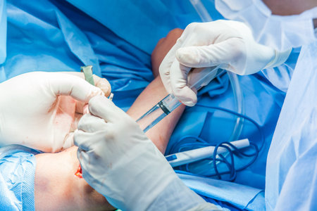 Group of surgeons performing an elbow surgery