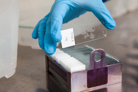 Scientist placing slides with paraffin embedded tissue samples into a slide staining rack. Fluorescent Immunohistochemistry staining of paraffin-embedded tissue sections.の写真素材