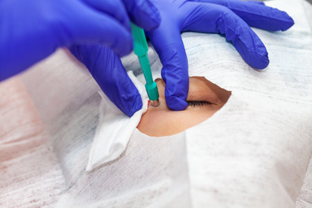 Skin lesion removal procedure. Dermatologist carrying out a removal of benign skin lesion on the face of a young male patient.の写真素材