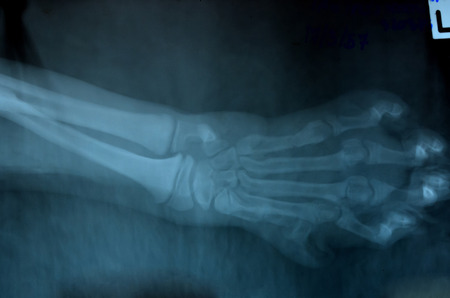 x ray picture of wild animal skeletonの写真素材