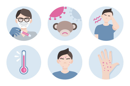 Set icons symptoms infographic of monkeypox virus 2022. Flat illustration for medical concept. vector illustrationのイラスト素材