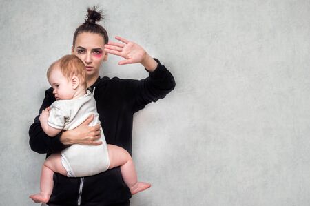 battered young woman with a bruise on her face and a child in her arms. Violence in familyの写真素材