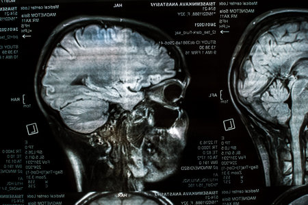 Magnetic resonance imaging of the brain close up. MRI