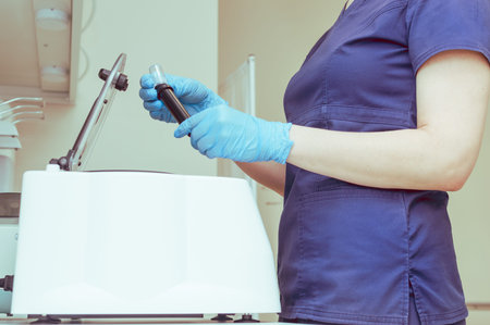 Doctor with test tubes at the plasma therapy centrifugeの写真素材