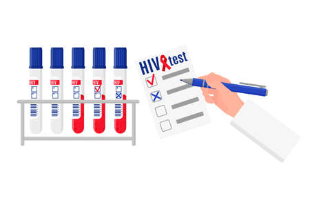 Vector cartoon illustration with stand and test tubes with blood test for HIV and blank with results isolated on white background. World AIDS Day.のイラスト素材