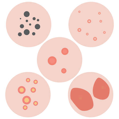 Picture of skin problems on a white background.のイラスト素材