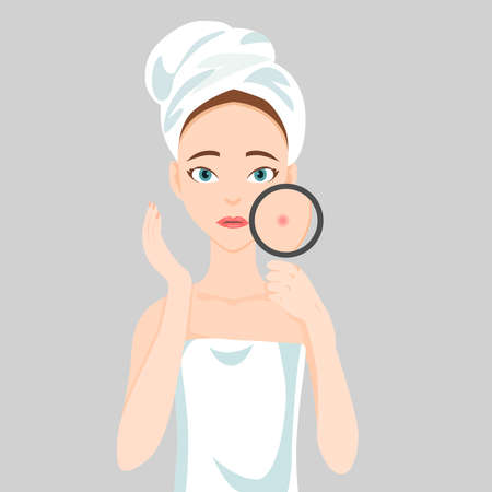 Picture of a girl with face problems on a white background.のイラスト素材