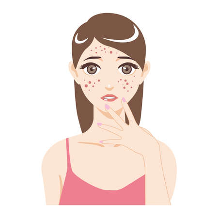 Picture of a girl with face problems on a white background.のイラスト素材