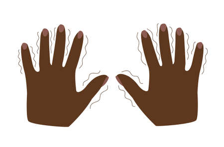 Tremor, trembling. Shivering in the hands symptom of mental disorders, panic, fear, parkenson's disease. Black skin, afro. flat vector illustration isolated on whiteのイラスト素材
