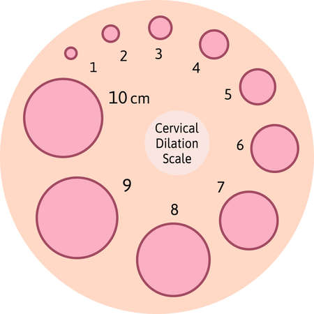Cervial Dilation Scale with pink circles. Cervical board. Shows how cervix is opening during delivery process. Medical Illustration chart in centimeters. Isolated on white background.