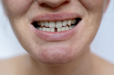 Close up of woman's mouth with white teeth with diastema in the lower row