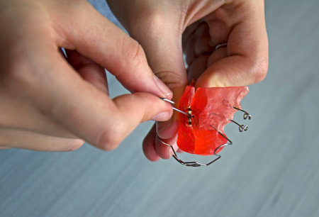 The girl shows how to properly tighten the plate for the teeth.の写真素材
