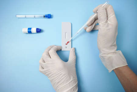 Doctor shows rapid laboratory a test kit for viral disease virus. Hand in medical glovesの写真素材