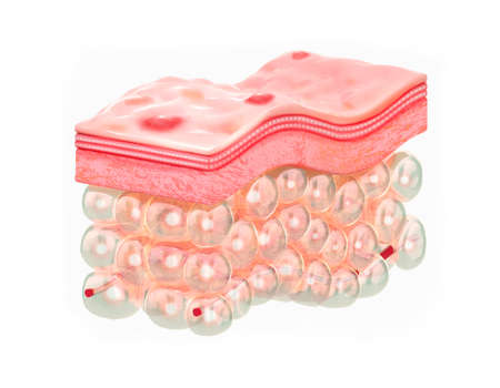Skin with acne. 3d illustration of the structure of the skin layers microstructure.Medical and educational pictures isolatedの写真素材