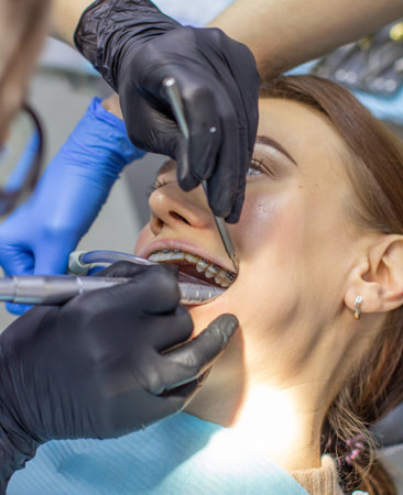 A woman at a dentists appointment to replace arches with braces