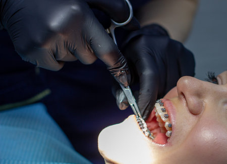 woman with braces visits an orthodontist, in a dental chair.during the procedure of installing the...