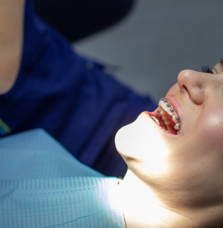A woman with braces on her teeth visits an orthodontist, in a dental chair. during the procedure of...