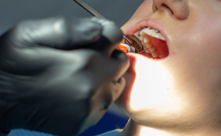 A woman at a dentists appointment to replace arches with braces.