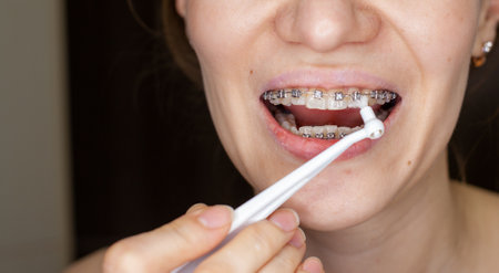Girl with braces on her teeth brushing her teeth with a toothbrush, close-up. Dental and oral care. Braces for leveling teethの写真素材