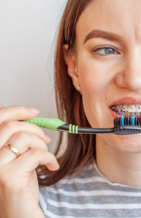 A girl with braces on her teeth smiles and holds a toothbrush.の写真素材