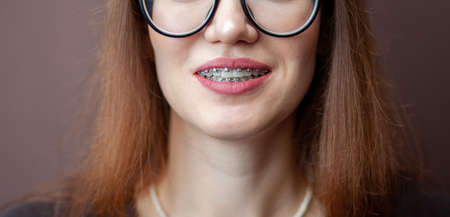 The smile of a young and beautiful girl with braces on her white teethの写真素材