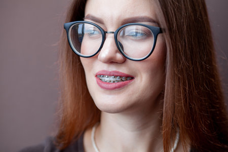 The smile of a young and beautiful girl with braces on her white teeth. Straightening of crooked teeth with the help of a bracket system. Malocclusion. Dental care. Smooth teeth and a beautiful smileの写真素材