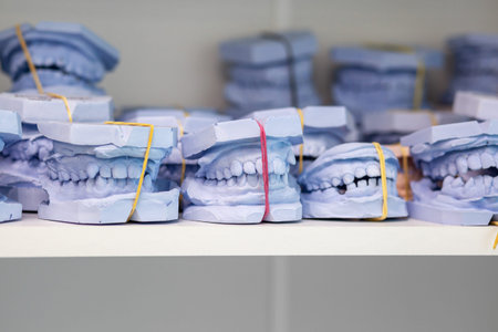 Dental gypsum models cast of a human dental jaw. Gypsum models lie on a shelf in a row. laboratory...
