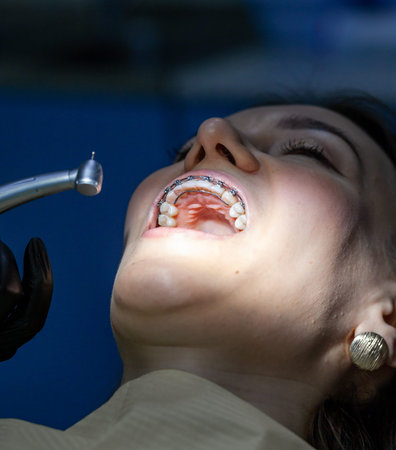 A woman at a dentists appointment to replace arches with braces