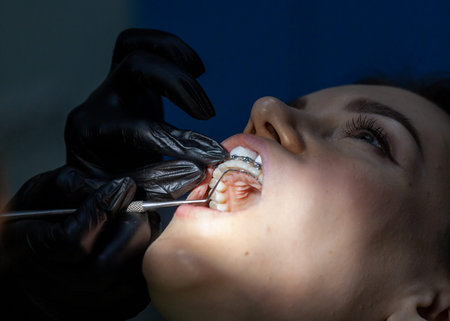 A woman at a dentists appointment to replace arches with braces