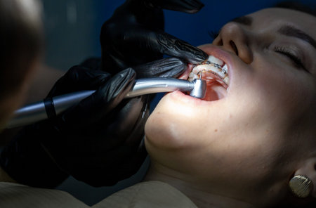 The process of removing braces.Beautiful woman in dental chair during procedure of installing braces...