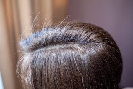 Parting of womens hair on the head. Hair care and care.