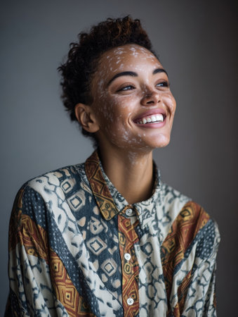Woman with distinct skin appearance smiles warmly while wearing a colorful patterned shirt in a well-lit indoor environment, capturing a joyful moment.の素材