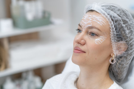 A woman relaxes in a well-lit treatment room as a specialist prepares for botulinum therapy. She has protective gear and product applied to her forehead.の写真素材