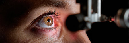 A close-up of a persons eye being examined under a slit lamp in a medical office, showing the intricate details of the iris and pupil.の素材